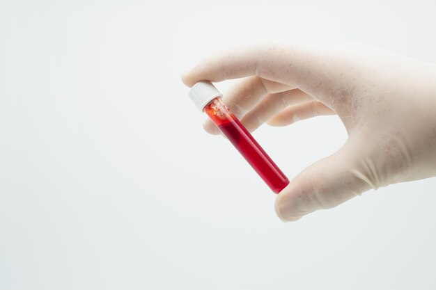 Более 500 тыс. россиян умерло от ВИЧ-инфекции за 40 лет